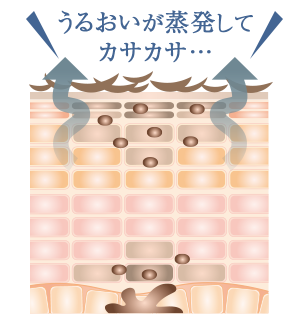 うるおいが蒸発してカサカサ…