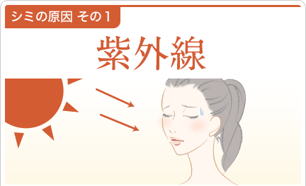 シミの原因その1 紫外線