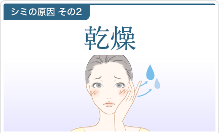 シミの原因その2 乾燥