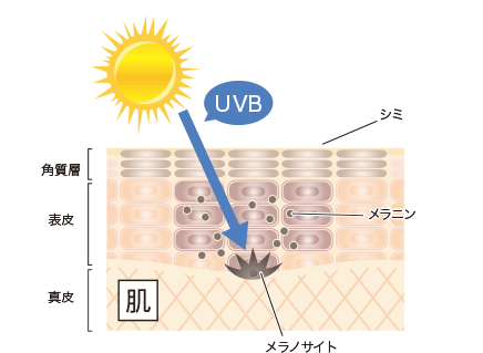 UVBの図