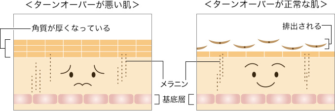 ターンオーバーが悪い肌と正常な肌
